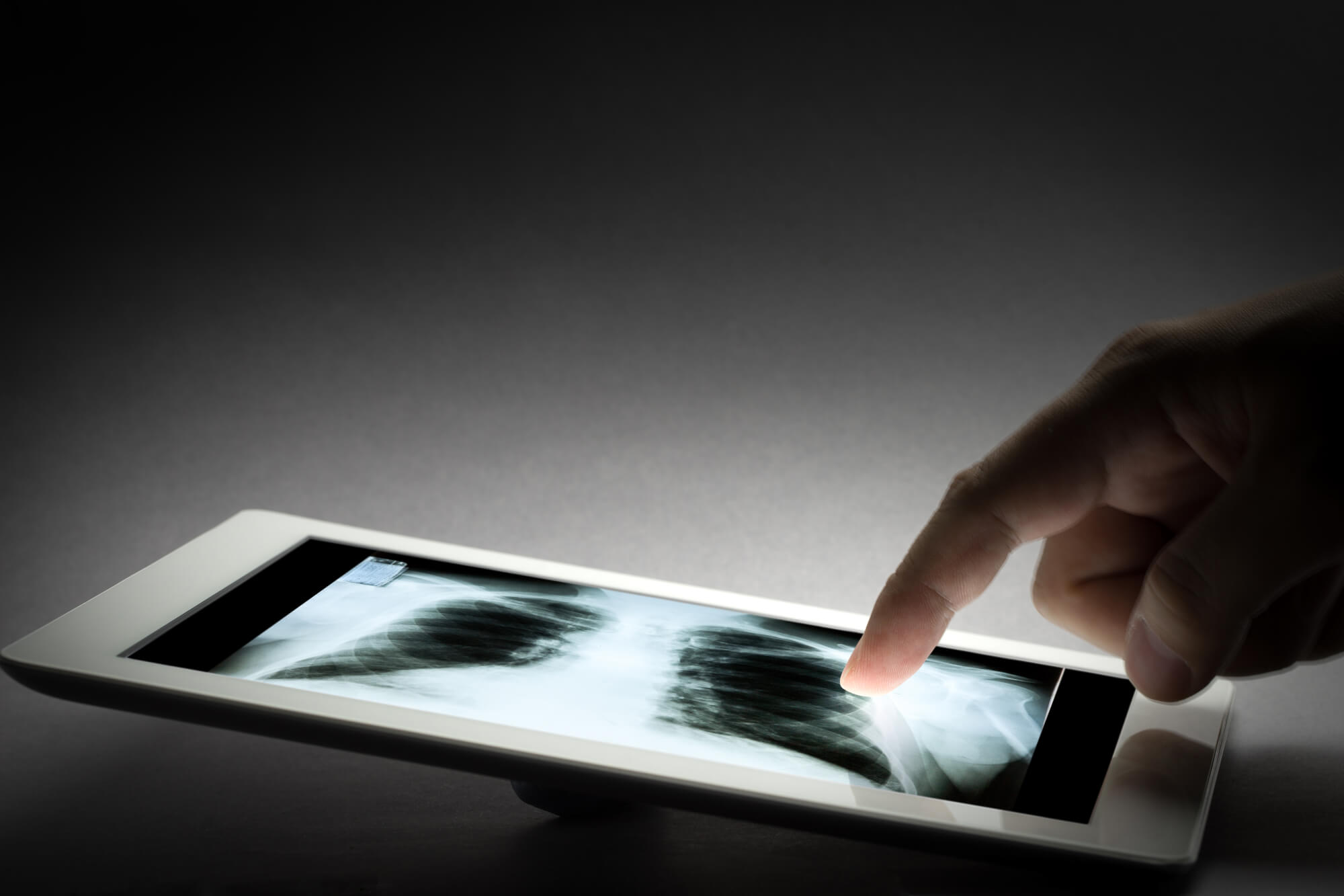 Human X Ray Film Exam By Doctor